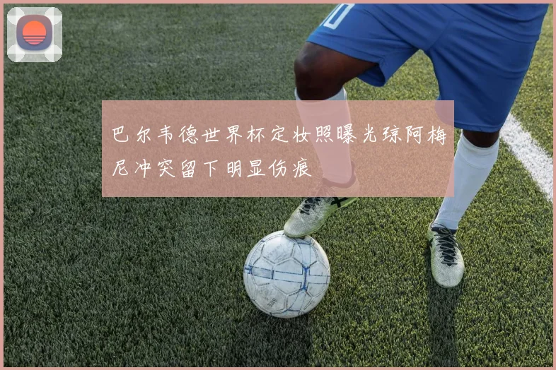 巴尔韦德世界杯定妆照曝光琼阿梅尼冲突留下明显伤痕